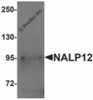 Western blot analysis of NALP12 in human brain tissue lysate with NALP12 antibody at 1 &#956;g/mL.