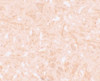 Immunohistochemistry of NALP12 in human brain tissue with NALP12 antibody at 5 ug/mL.