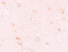 Immunohistochemistry of CIITA in human brain tissue with CIITA antibody at 10 ug/mL.