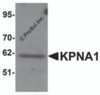 Western blot analysis of KPNA1 in Hela cell lysate with KPNA1 antibody at 1&#956;g/mL.