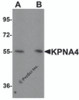 Western blot analysis of KPNA4 in HeLa cell lysate with KPNA4 antibody at (A) 0.5 and (B) 1 &#956;g/mL.