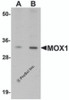 Western blot analysis of MOX1 in human liver tissue lysate with MOX1 antibody at (A) 1 and (B) 2 &#956;g/mL.