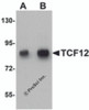 Western blot analysis of TCF12 in HeLa cell lysate with TCF12 antibody at (A) 0.5 and (B) 1 &#956;g/mL.