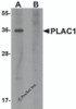 Western blot analysis of PLAC1 in human placenta tissue lysate with PLAC1 antibody at 1 &#956;g/mL in (A) the absence and (B) the presence of blocking peptide.