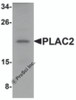 Western blot analysis of PLAC2 in HeLa cell lysate with PLAC2 antibody at 1 &#956;g/mL.