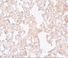 Immunohistochemistry of MFSD1 in rat lung tissue with MFSD1 antibody at 10 ug/mL.