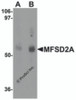 Western blot analysis of MFSD2A in rat lung tissue lysate with MFSD2A antibody at (A) 1 and (B) 2 &#956;g/mL.