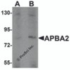 Western blot analysis of APBA2 in human brain tissue lysate with APBA2 antibody at (A) 1 and (B) 2 &#956;g/mL.