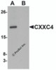 Western blot analysis of CXXC4 in human brain tissue lysate with CXXC4 antibody at 1 &#956;g/mL in (A) the absence and (B) the presence of blocking peptide.