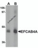 Western blot analysis of EFCAB4A in human lung tissue lysate with EFCAB4A antibody at (A) 1 and (B) 2 &#956;g/mL.