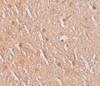 Immunohistochemistry of LMBRD1 in human brain tissue with LMBRD1 antibody at 2.5 ug/mL.
