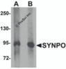 Western blot analysis of SYNPO in rat brain tissue lysate with SYNPO antibody at (A) 1 and (B) 2 &#956;g/mL.