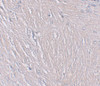 Immunohistochemistry of SYNPO in human brain tissue with SYNPO antibody at 2.5 ug/mL.
