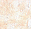 Immunohistochemistry of SYNPO2 in mouse skeletal muscle tissue with SYNPO2 antibody at 5 ug/mL.