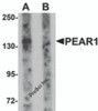 Western blot analysis of PEAR1 in rat kidney tissue lysate with PEAR1 antibody at 1 &#956;g/mL in (A) the absence and (B) the presence of blocking peptide.