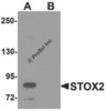 Western blot analysis of STOX2 in human kidney tissue lysate with STOX2 antibody at 1 &#956;g/mL in (A) the absence and (B) the presence of blocking peptide.