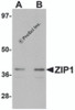 Western blot analysis of ZIP1 in mouse kidney tissue lysate with ZIP1 antibody at (A) 1 and (B) 2 &#956;g/mL.