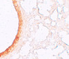 Immunohistochemistry of ZIP3 in mouse lung tissue with ZIP3 antibody at 5 ug/mL.