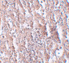 Immunohistochemistry of ZIP5 in human spleen tissue with ZIP5 antibody at 2.5 ug/mL.