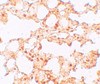 Immunohistochemistry of ZIP6 in mouse lung tissue with ZIP6 antibody at 5 ug/mL.