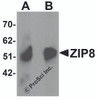 Western blot analysis of ZIP8 in human spleen tissue lysate with ZIP8 antibody at (A) 1 and (B) 2 &#956;g/mL.