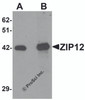 Western blot analysis of ZIP12 in HepG2 cell lysate with ZIP12 antibody at (A) 0.5 and (B) 1 &#956;g/mL.