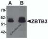 Western blot analysis of ZBTB3 in rat brain tissue lysate with ZBTB3 antibody at (A) 1 and (B) 2 &#956;g/mL.