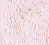 Immunohistochemistry of ZBTB7A in human ovary tissue with ZBTB7A antibody at 2.5 ug/mL.