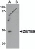 Western blot analysis of ZBTB9 in mouse heart tissue lysate with ZBTB9 antibody at 1 &#956;g/mL in (A) the absence and (B) the presence of blocking peptide.