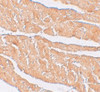 Immunohistochemistry of ZBTB9 in mouse heart tissue with ZBTB9 antibody at 2.5 ug/mL.