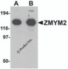 Western blot analysis of ZMYM2 in EL4 cell lysate with ZMYM2 antibody at (A) 0.125 and (B) 0.25 &#956;g/mL.