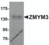 Western blot analysis of ZMYM3 in human brain tissue lysate with ZMYM3 antibody at 1 &#956;g/mL.