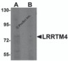 Western blot analysis of LRRTM4 in HeLa cell lysate with LRRTM4 antibody at 1 &#956;g/mL in (A) the absence and (B) the presence of blocking peptide.