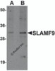 Western blot analysis of SLAMF9 in mouse kidney tissue lysate with SLAMF9 antibody at (A) 1 and (B) 2 &#956;g/mL.