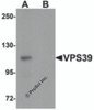Western blot analysis of VPS39 in rat liver tissue lysate with VPS39 antibody at 0.5 &#956;g/mL in (A) the absence and (B) the presence of blocking peptide.