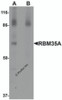 Western blot analysis of RBM35A in rat colon tissue lysate with RBM35A antibody at 0.5 &#956;g/mL in (A) the absence and (B) the presence of blocking peptide.