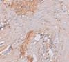 Immunohistochemistry of RBM35A in human colon tissue with RBM35A antibody at 2.5 ug/mL.