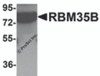 Western blot analysis of RBM35B in human lung tissue lysate with RBM35B antibody at 1 &#956;g/mL.