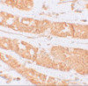 Immunohistochemistry of RHAMM in human stomach tissue with RHAMM antibody at 2.5 ug/mL.
