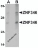 Western blot analysis of ZNF346 in human kidney tissue lysate with ZNF346 antibody at (A) 1 and (B) 2 &#956;g/mL.