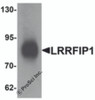 Western blot analysis of LRRFIP1 in human colon tissue lysate with LRRFIP1 antibody at 1 &#956;g/mL.