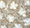 Immunohistochemistry of LRRFIP1 in human colon tissue with LRRFIP1 antibody at 5 ug/mL.