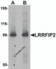 Western blot analysis of LRRFIP2 in rat colon tissue lysate with LRRFIP2 antibody at (A) 0.5 and (B) 1 &#956;g/mL.