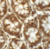 Immunohistochemistry of LRRFIP2 in human colon tissue with LRRFIP2 antibody at 5 ug/mL.