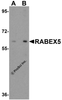 Western blot analysis of RABEX5 in human liver tissue lysate with RABEX5 antibody at (A) 1 and (B) 2 &#956;g/mL.