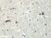 Immunohistochemistry of RABEX5 in mouse brain tissue with RABEX5 antibody at 5 ug/mL.