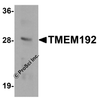 Western blot analysis of TMEM192 in SK-N-SH cell lysate with TMEM192 antibody at 0.5 &#956;g/mL.