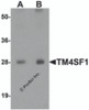 Western blot analysis of TM4SF1 in human lung tissue lysate with TM4SF1 antibody at (A) 0.5 and (B) 1 &#956;g/mL.