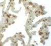 Immunohistochemistry of TM4SF1 in human lung tissue with TM4SF1 antibody at 5 ug/mL.