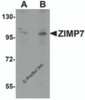 Western blot analysis of ZIMP7 in A20 cell lysate with ZIMP7 antibody at (A) 0.25 &#956;g/ml and (B) 0.5 &#956;g/mL.